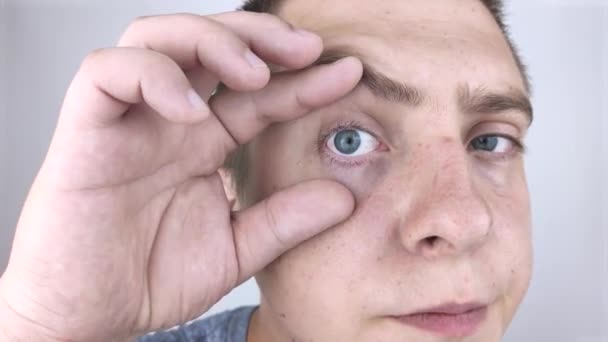Κοντινό πλάνο δύο ενοχλημένων κόκκινων ματιών του αίματος των αρσενικών που έχουν προσβληθεί από επιπεφυκίτιδα ή μετά από γρίπη, κρυολόγημα, αλλεργία. Αντιγραφή χώρου για διαφήμιση. Κουρασμένα μάτια αφού δούλεψα στον υπολογιστή. Κοντινό πλάνο και μακροεντολή - Πλάνα, βίντεο