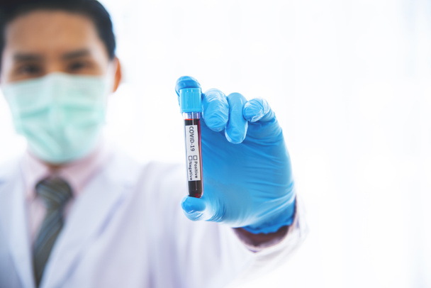 Bir virüsün kan damarlarını taşıyan doktor 2019-nCoV kan testi konsepti için test edilmek üzere hastaya hastalık bulaştırdı. - Fotoğraf, Görsel