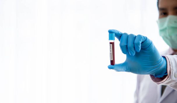 doctor carrying the blood vessels of a virus infected patient to be tested for analysis 2019-nCoV blood test concept Coronavirus that is currently plagued - Foto, Bild