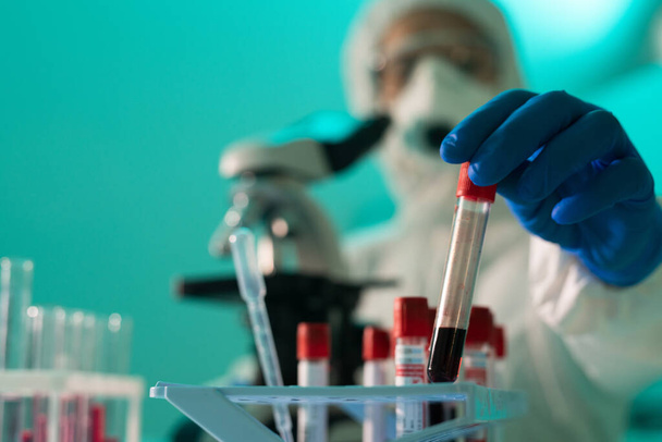 Close-up de especialista em laboratório irreconhecível em luvas verificando sangue para anticorpos coronavírus em laboratório
 - Foto, Imagem