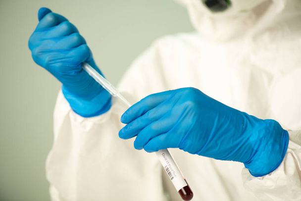 Gros plan d'un chimiste de laboratoire méconnaissable portant des gants et une combinaison de protection ajoutant un réactif dans un échantillon de sang - Photo, image