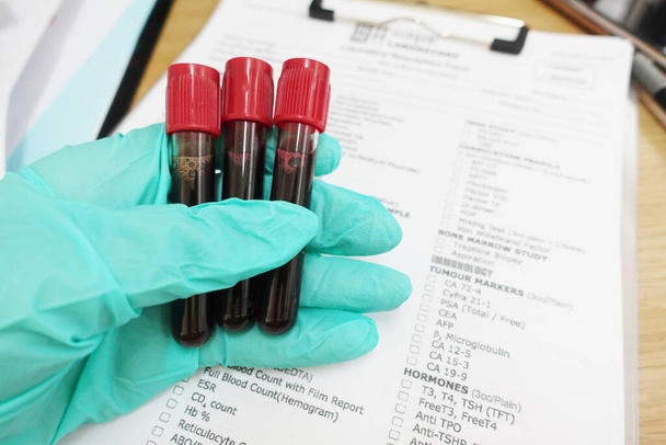 Esami del sangue in laboratorio in ospedale     - Foto, immagini