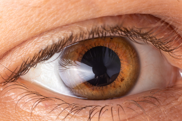 Foto de ojo macro. Queratocono: enfermedad ocular, adelgazamiento de la córnea en forma de cono. El plástico de la córnea - Foto, imagen