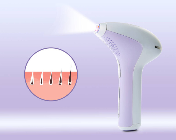 Epilation procedure. Modern appliance and illustration of hair follicle growth on light background - Foto, immagini