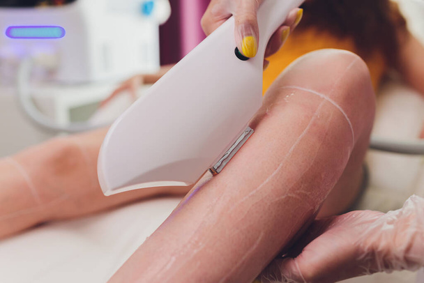 Laser hair removal on ladies legs. Intentional shallow depth of field. - Zdjęcie, obraz