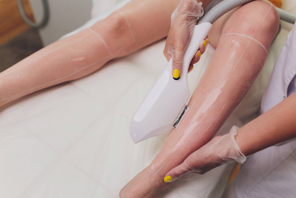 Laser hair removal on ladies legs. Intentional shallow depth of field. - Zdjęcie, obraz