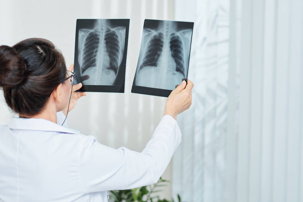 Пульмонолог, що перевіряє рентгенівські промені пацієнта з пневмонією, вид ззаду
 - Фото, зображення