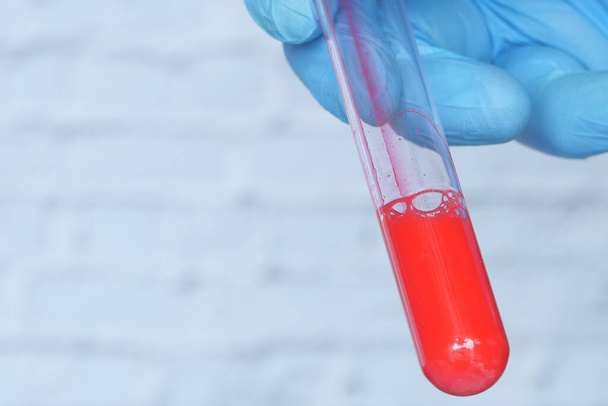 laboratorio tecnico mano tenendo sangue provetta  - Foto, immagini