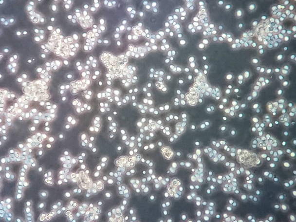 Yeast cells under microscope view - Photo, Image
