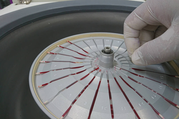 Máquina de teste de sangue em laboratório
    - Foto, Imagem