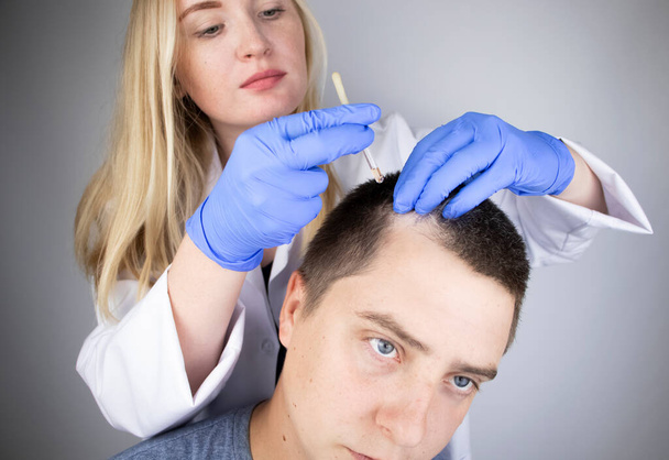 Um médico tricologista pinga o soro no cabelo do paciente. Tratamento da alopecia. Perda de cabelo, alopecia, prurido, cabeça ardente ou seborreia
 - Foto, Imagem