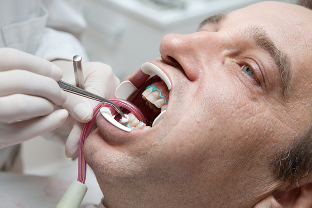 Male patient with dentist in a dental treatment - Fotó, kép
