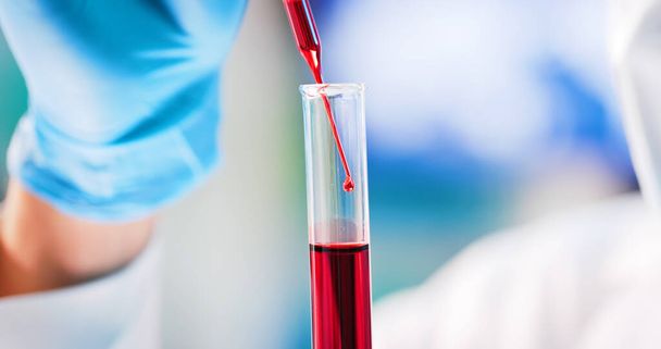 microbiologist or medical worker use test tube filling with blood in the laboratory - 写真・画像
