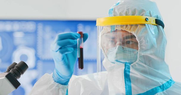 asian male scientist researcher holding a positive blood test result for the Coronavirus with isolation gown or protective suits and surgical face mask - Photo, image