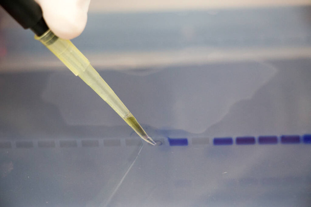 ポリメラーゼ連鎖反応(PCR)とアガロースゲル電気泳動は、研究室で生化学、分子生物学、遺伝学、臨床化学に用いられるゲル電気泳動法である。. - 写真・画像