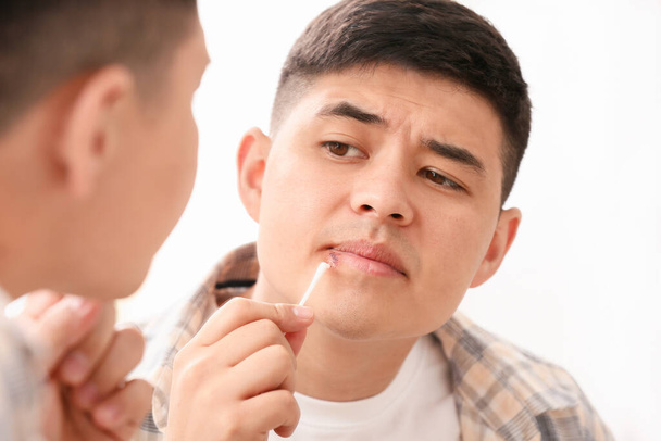Aziatische man met koortslip aanbrengen van zalf op zijn lippen in de buurt spiegel - Foto, afbeelding