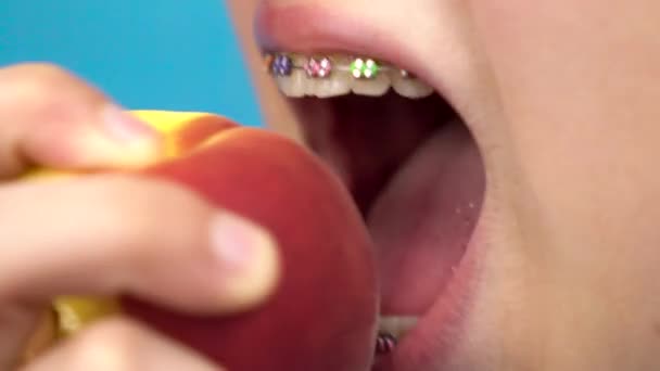 Chica adolescente con aparatos ortopédicos en los dientes se come un melocotón sobre un fondo azul. Chica con frenos de colores muerde de un primer plano melocotón
. - Imágenes, Vídeo