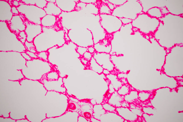 Ihmisen keuhkokudos mikroskoopilla. Keuhkot ovat ihmisen ja monien muiden eläinten hengityselinten ensisijaisia elimiä - Valokuva, kuva