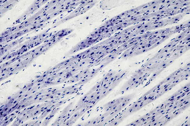 Histología del músculo cardíaco bajo la vista del microscopio
 - Foto, Imagen