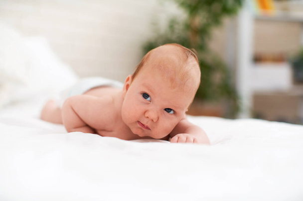 plump Caucasian baby of 4 months with a diathesis on his head, lying on his stomach on a soft knitted blanket and looking away. A small child learns to crawl. Allergies in children. A copy of space. - Foto, Imagen