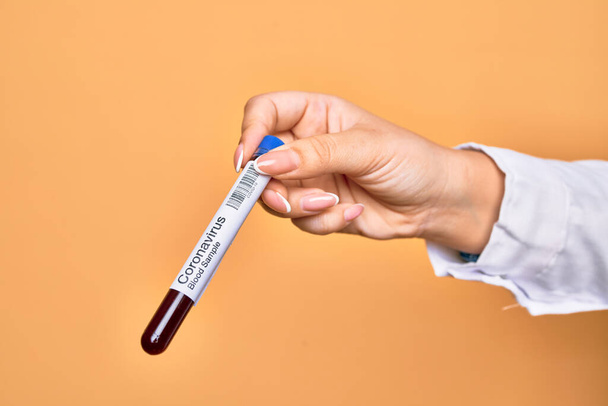 Mão da jovem caucasiana segurando tubo de testes com resultados de coronavírus sobre fundo amarelo isolado - Foto, Imagem