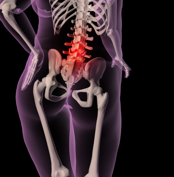 Túlsúlyos nő csontváza hátfájás - Fotó, kép