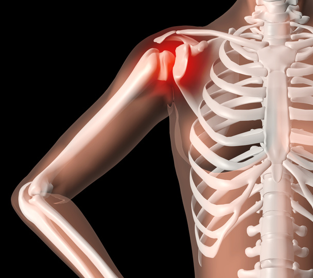 Esqueleto femenino con dolor de hombro
 - Foto, imagen