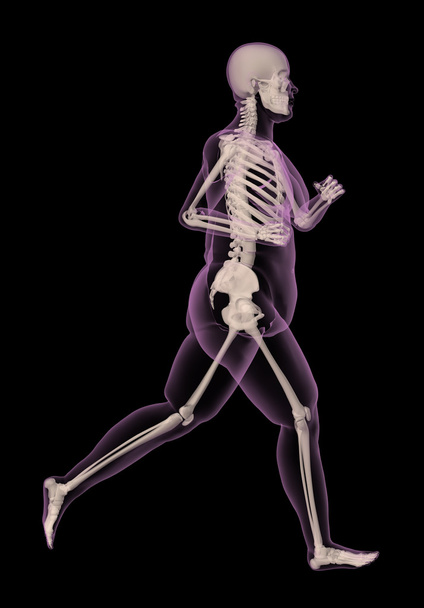 Orvosi csontváz egy túlsúlyos nő fut - Fotó, kép