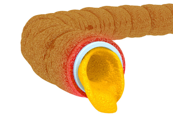 Artéria elzáródott koleszterin.3d render - Fotó, kép