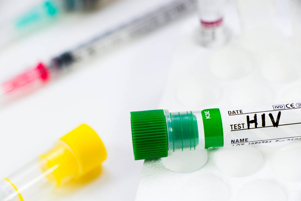 HIV e aiuta il test di infezione, i medici viso e mano tubo con sangue sullo sfondo blu. Studio sparare. - Foto, immagini