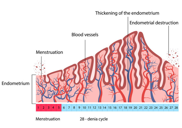 cambios en la destrucción endometrial uterina
 - Vector, imagen
