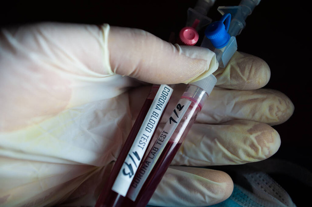 Profesjonalny lekarz lub technik laboratoryjny posiadający próbkę krwi z nowym (nowym) koronawirusem N.C.P. po raz pierwszy zidentyfikowany w Wuhan, prowincja Hubei, Chiny, medycyny i opieki zdrowotnej - Zdjęcie, obraz
