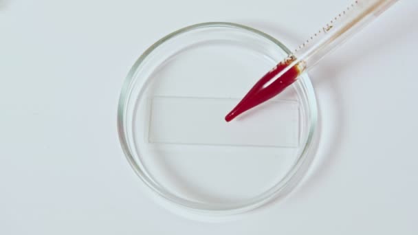blood test hands red sample petri dish pipette - Filmati, video