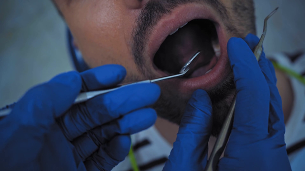 Vista dall'alto del dentista che esamina i denti del paziente con strumenti dentali in clinica - Filmati, video