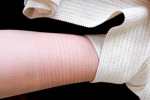Le bandage médical a laissé une marque sur la peau. Bandage élastique beige. - Photo, image