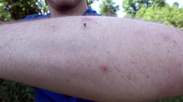 Mosquito sání krve na lidské kůži - Záběry, video