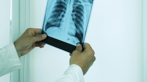 he doctor looks at the x-ray of the lungs,points his finger at the problem areas,says something,diagnoses pneumonia of the lungs.Close-up - Video, Çekim