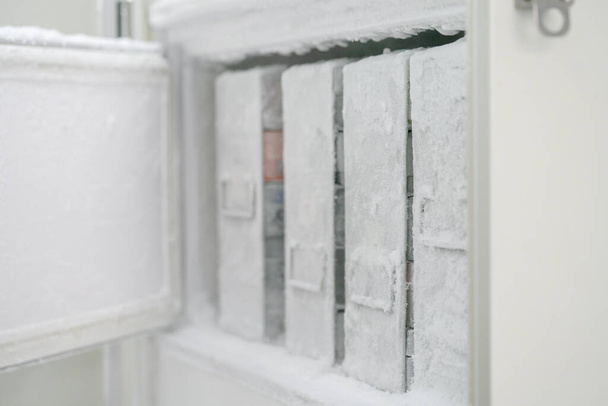Congelador de laboratorio para mantener aislado el patógeno en temperaturas ultra bajas
. - Foto, Imagen