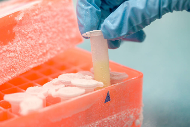 Keep isolated pathogen in ultra low temperature in the Laboratory freezer. - Photo, Image