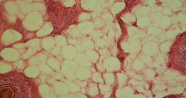 Cuero cabelludo con raíces pilosas en sección transversal muy agrandada bajo el microscopio
 - Metraje, vídeo