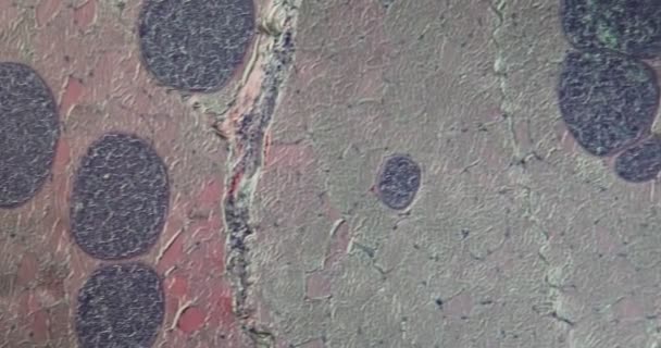 Sarcocystis loinen infektio apina kudos suurennettuna mikroskoopilla - Materiaali, video
