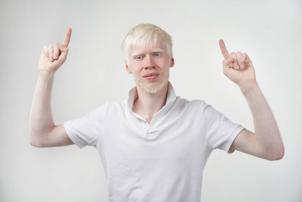 albinism albino man white skin hair studio dressed t-shirt isolated white background abnormal deviations unusual appearance abnormality Beautiful people  Shows two fingers up. - Valokuva, kuva