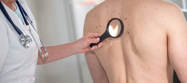 Дерматолог осматривает кожу на спине пациента - Фото, изображение