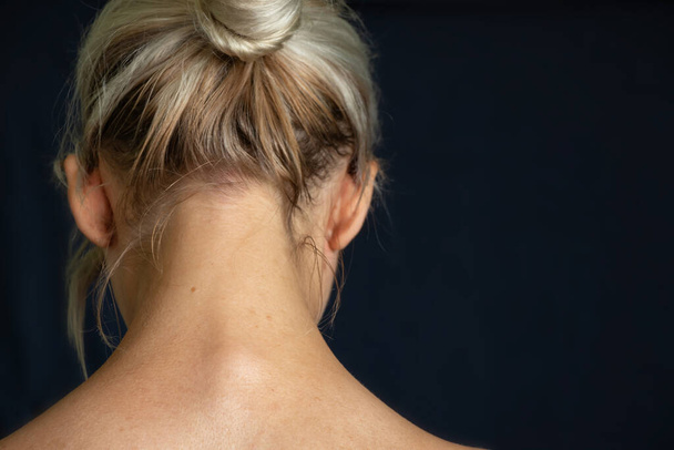 una joven inclinó la cabeza y mostró la columna vertebral con su curvatura de cerca
 - Foto, Imagen