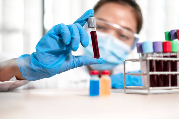 Professional doctors perform find virus tests from samples of blood tests to diagnose coronary virus infections analysis and sampling of infectious. - Foto, Bild