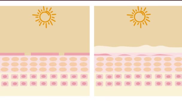 Protezione della pelle dalla luce e dai raggi UV con animazione grafica prima e dopo. Lozioni o creme gocciolano sulla pelle per aumentare l'umidità. - Filmati, video