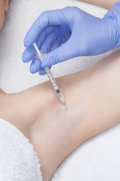 The doctor makes intramuscular injections of botulinum toxin in the underarm area against hyperhidrosis. - Photo, Image
