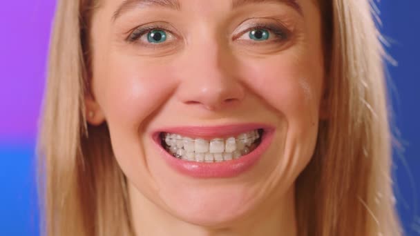 Fehér nő kék szemekkel és fogszabályzóval a fogain mosolyog és a kamerába néz.. - Felvétel, videó