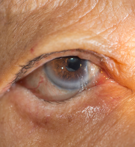 Eye examination. - Photo, Image
