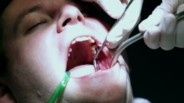 Dentist trying to fix clients teeth with his dental tools - Footage, Video